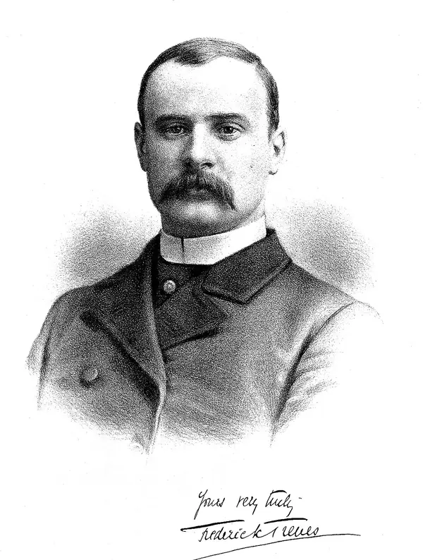 Sir Frederick Treves, lithograph, 1884