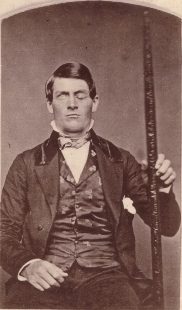 Phineas Gage holding the tamping iron (Gage family collection, identified 2010)